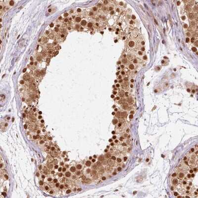 Immunohistochemistry-Paraffin: cleavage stimulation factor Antibody [NBP2-33486] - Staining of human testis shows strong nuclear and cytoplasmic positivity in cells in seminiferus ducts.