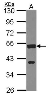 Western Blot: cleavage stimulation factor Antibody [NBP2-15913] - Sample (30 ug of whole cell lysate) A: A431 10% SDS PAGE gel, diluted at 1:1000.