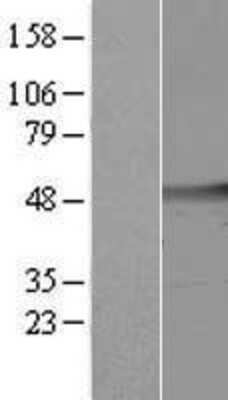 Western Blot: cleavage stimulation factor Overexpression Lysate (Adult Normal) [NBP2-11206] Left-Empty vector transfected control cell lysate (HEK293 cell lysate); Right -Over-expression Lysate for cleavage stimulation factor.