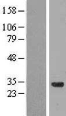 Western Blot coiled-coil domain containing 53 Overexpression Lysate