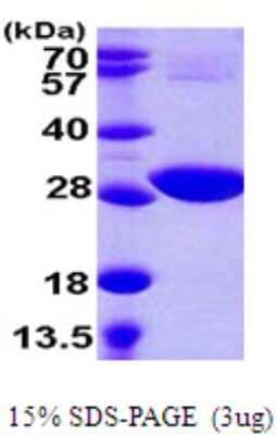 SDS-Page: cysH Protein [NBP2-22650]