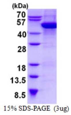 SDS-Page: cytohesin 2 Protein [NBP2-22983]