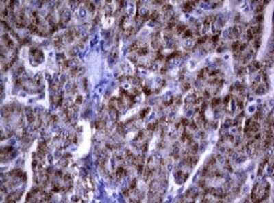 Immunohistochemistry: dedicator of cytokinesis 8 Antibody (12D7) [NBP2-46470] - Analysis of Human liver tissue. (Heat-induced epitope retrieval by 1 mM EDTA in 10mM Tris, pH9.0, 120C for 3min)