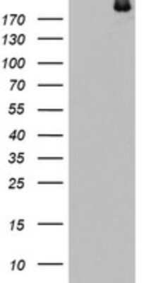 Western Blot: dedicator of cytokinesis 8 Antibody (12D7) [NBP2-46470] - Analysis of HEK293T cells were transfected with the pCMV6-ENTRY control (Left lane) or pCMV6-ENTRY cytokinesis 8.