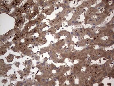 Immunohistochemistry: dedicator of cytokinesis 8 Antibody (4H10) [NBP2-46471] - Analysis of Human liver tissue. (Heat-induced epitope retrieval by 1 mM EDTA in 10mM Tris, pH8.5, 120C for 3min)