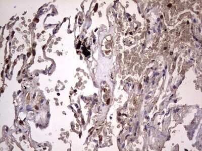 Immunohistochemistry: dedicator of cytokinesis 8 Antibody (4H10) [NBP2-46471] - Analysis of Human lung tissue. (Heat-induced epitope retrieval by 1 mM EDTA in 10mM Tris, pH8.5, 120C for 3min)