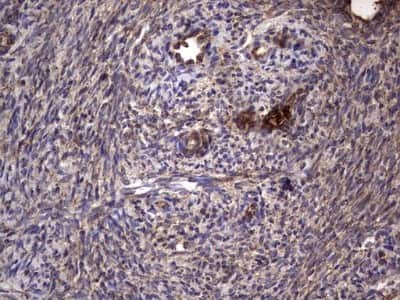 Immunohistochemistry: dedicator of cytokinesis 8 Antibody (4H10) [NBP2-46471] - Analysis of Human Ovary tissue. (Heat-induced epitope retrieval by 1 mM EDTA in 10mM Tris, pH8.5, 120C for 3min)