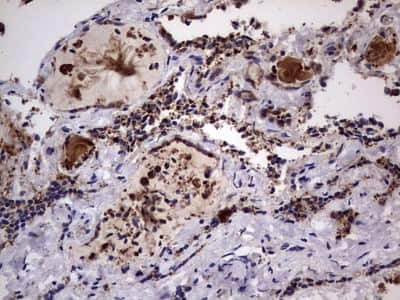 Immunohistochemistry: dedicator of cytokinesis 8 Antibody (4H10) [NBP2-46471] - Analysis of Human thyroid tissue. (Heat-induced epitope retrieval by 1 mM EDTA in 10mM Tris, pH8.5, 120C for 3min)