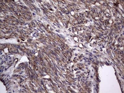 Immunohistochemistry: dedicator of cytokinesis 8 Antibody (4H10) [NBP2-46471] - Analysis of Human endometrium tissue. (Heat-induced epitope retrieval by 1 mM EDTA in 10mM Tris, pH8.5, 120C for 3min)