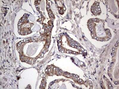 Immunohistochemistry: dedicator of cytokinesis 8 Antibody (4H10) [NBP2-46471] - Analysis of Human prostate tissue. (Heat-induced epitope retrieval by 1 mM EDTA in 10mM Tris, pH8.5, 120C for 3min)