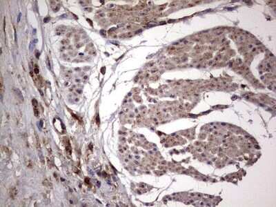 Immunohistochemistry: dedicator of cytokinesis 8 Antibody (4H10) [NBP2-46471] - Analysis of Human bladder tissue. (Heat-induced epitope retrieval by 1 mM EDTA in 10mM Tris, pH8.5, 120C for 3min)