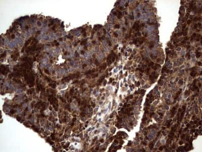 Immunohistochemistry: dedicator of cytokinesis 8 Antibody (4H10) [NBP2-46471] - Analysis of Human lymph node tissue. (Heat-induced epitope retrieval by 1 mM EDTA in 10mM Tris, pH8.5, 120C for 3min)