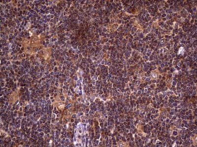 Immunohistochemistry: dedicator of cytokinesis 8 Antibody (4H10) [NBP2-46471] - Analysis of Human lymphoma tissue. (Heat-induced epitope retrieval by 1 mM EDTA in 10mM Tris, pH8.5, 120C for 3min)