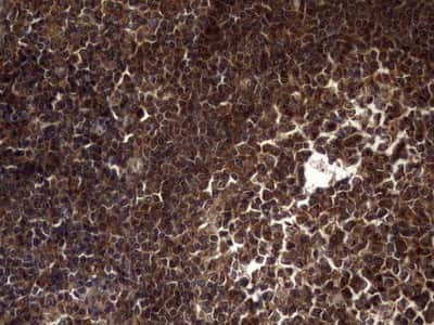 Immunohistochemistry: dedicator of cytokinesis 8 Antibody (4H10) [NBP2-46471] - Analysis of Human tonsil tissue. (Heat-induced epitope retrieval by 1 mM EDTA in 10mM Tris, pH8.5, 120C for 3min)