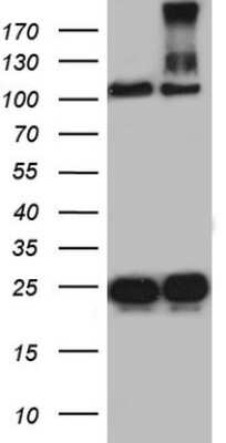 Western Blot: dedicator of cytokinesis 8 Antibody (4H10) [NBP2-46471] - Analysis of HEK293T cells were transfected with the pCMV6-ENTRY control (Left lane) or pCMV6-ENTRY dedicator of cytokinesis 8.