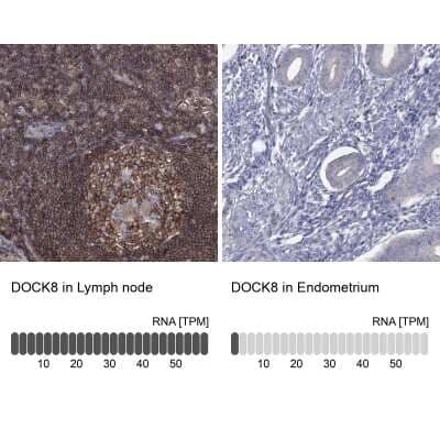 Immunohistochemistry-Paraffin: dedicator of cytokinesis 8 Antibody [NBP3-17049] - Analysis in human lymph node and endometrium tissues using Anti-DOCK8 antibody. Corresponding DOCK8 RNA-seq data are presented for the same tissues.