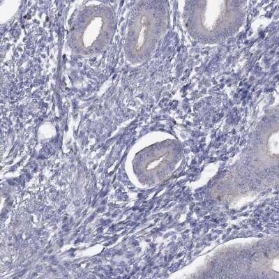 Immunohistochemistry-Paraffin: dedicator of cytokinesis 8 Antibody [NBP3-17049] - Staining of human endometrium shows low expression as expected.