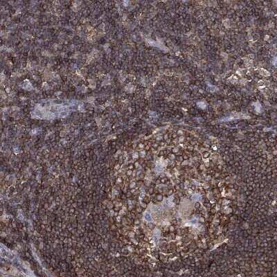 Immunohistochemistry-Paraffin: dedicator of cytokinesis 8 Antibody [NBP3-17049] - Staining of human lymph node shows high expression.