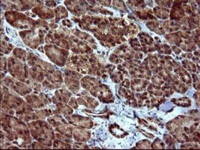 Immunohistochemistry: dedicator of cytokinesis 8 Antibody (OTI4F3) - Azide and BSA Free [NBP2-72226] - Analysis of Human pancreas tissue. (Heat-induced epitope retrieval by 10mM citric buffer, pH6.0, 120C for 3min)