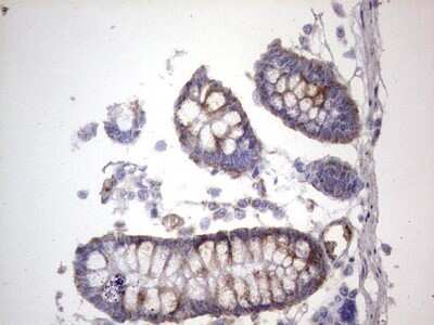 Immunohistochemistry: dedicator of cytokinesis 8 Antibody (OTI4H10) - Azide and BSA Free [NBP2-72228] - Analysis of Human colon tissue. (Heat-induced epitope retrieval by 1 mM EDTA in 10mM Tris, pH8.5, 120C for 3min)