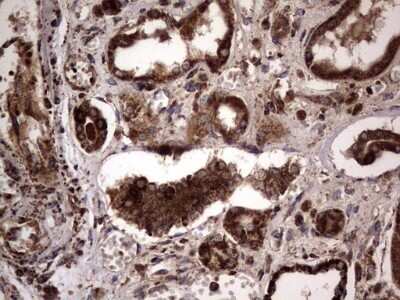 Immunohistochemistry: dedicator of cytokinesis 8 Antibody (OTI4H10) - Azide and BSA Free [NBP2-72228] - Analysis of Human Kidney tissue. (Heat-induced epitope retrieval by 1 mM EDTA in 10mM Tris, pH8.5, 120C for 3min)