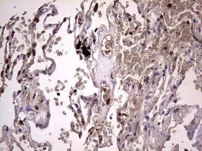 Immunohistochemistry: dedicator of cytokinesis 8 Antibody (OTI4H10) - Azide and BSA Free [NBP2-72228] - Analysis of Human lung tissue. (Heat-induced epitope retrieval by 1 mM EDTA in 10mM Tris, pH8.5, 120C for 3min)