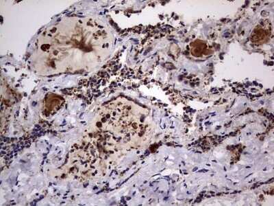 Immunohistochemistry: dedicator of cytokinesis 8 Antibody (OTI4H10) - Azide and BSA Free [NBP2-72228] - Analysis of Human thyroid tissue. (Heat-induced epitope retrieval by 1 mM EDTA in 10mM Tris, pH8.5, 120C for 3min)