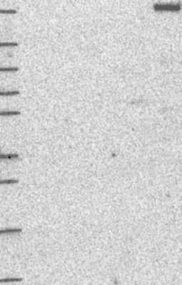 Western Blot: dedicator of cytokinesis 8 Antibody [NBP3-17049] - Lane 1: Marker [kDa] 250, 130, 95, 72, 55, 36, 28, 17, 10;   Lane 2: RT4;   Lane 3: U-251 MG;   Lane 4: Human Plasma;   Lane 5: Liver;   Lane 6: Tonsil