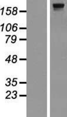 Western Blot: dedicator of cytokinesis 8 Overexpression Lysate (Adult Normal) [NBP2-04554] Left-Empty vector transfected control cell lysate (HEK293 cell lysate); Right -Over-expression Lysate for dedicator of cytokinesis 8.