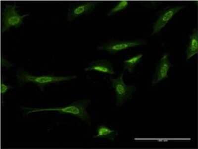 Immunocytochemistry/Immunofluorescence: delta 2 Catenin Antibody (1E3) [H00001501-M02] - Analysis of monoclonal antibody to CTNND2 on HeLa cell . Antibody concentration 10 ug/ml.