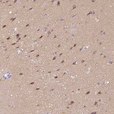 Immunohistochemistry: delta 2 Catenin Antibody [NBP2-47487] - Staining of human cerebral cortex shows moderate cytoplasmic and nuclear positivity in neuronal cells, neuropil displayed moderate cytoplasmic staining.