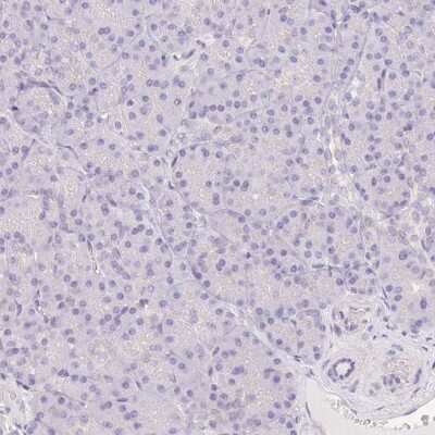 <b>Orthogonal Strategies Validation. </b>Immunohistochemistry-Paraffin: delta 2 Catenin Antibody [NBP2-47487] - Staining of human pancreas shows low expression as expected.