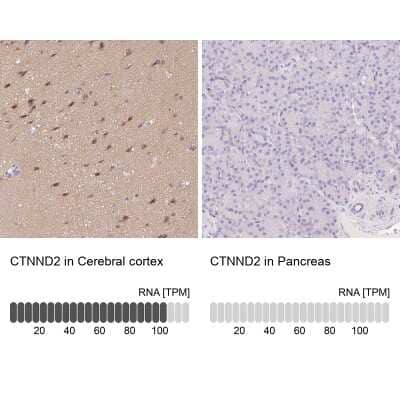 Immunohistochemistry-Paraffin delta 2 Catenin Antibody - BSA Free