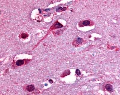 Immunohistochemistry-Paraffin: delta Opioid R/OPRD1 Antibody [NLS226] - Analysis of anti-Delta Opioid Receptor antibody with human brain, neurons and glia at 15 ug/ml.