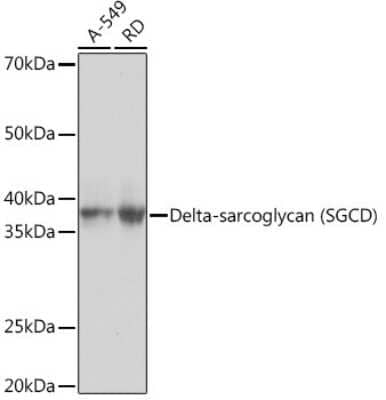 Western Blot: delta-Sarcoglycan Antibody (3P3R4) [NBP3-16776] - Western blot analysis of extracts of various cell lines, using delta-Sarcoglycan Rabbit mAb (NBP3-16776) at 1:1000 dilution. Secondary antibody: HRP Goat Anti-Rabbit IgG (H+L) at 1:10000 dilution. Lysates/proteins: 25ug per lane. Blocking buffer: 3% nonfat dry milk in TBST. Detection: ECL Basic Kit. Exposure time: 3s.