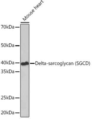 Western Blot: delta-Sarcoglycan Antibody (3P3R4) [NBP3-16776] - Western blot analysis of extracts of Mouse heart, using delta-Sarcoglycan Rabbit mAb (NBP3-16776) at 1:1000 dilution. Secondary antibody: HRP Goat Anti-Rabbit IgG (H+L) at 1:10000 dilution. Lysates/proteins: 25ug per lane. Blocking buffer: 3% nonfat dry milk in TBST. Detection: ECL Basic Kit. Exposure time: 90s.