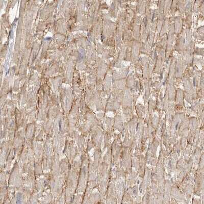 Immunohistochemistry-Paraffin: delta Sarcoglycan Antibody [NBP1-85545] - Staining of human heart muscle shows distinct membranous positivity in myocytes.