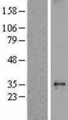 Western Blot: delta Sarcoglycan Overexpression Lysate (Adult Normal) [NBL1-15904] Left-Empty vector transfected control cell lysate (HEK293 cell lysate); Right -Over-expression Lysate for delta Sarcoglycan.