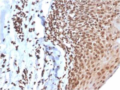 Immunohistochemistry-Paraffin: dsDNA Antibody (DSD/4054R) - Azide and BSA Free [NBP3-08490] - Formalin-fixed, paraffin-embedded human tonsil stained with dsDNA Recombinant Rabbit Monoclonal Antibody (DSD/4054R).