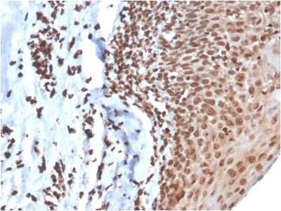 Immunohistochemistry-Paraffin: dsDNA Antibody (DSD/4054R) [NBP3-07302] - Formalin-fixed, paraffin-embedded human tonsil stained with dsDNA Recombinant Rabbit Monoclonal Antibody (DSD/4054R).