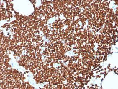 Immunohistochemistry-Paraffin: dsDNA Antibody (rDSD/4565) - Azide and BSA Free [NBP3-08466] - Formalin-fixed, paraffin-embedded human lymph node stained with dsDNA Recombinant Mouse Monoclonal Antibody (rDSD/4565).