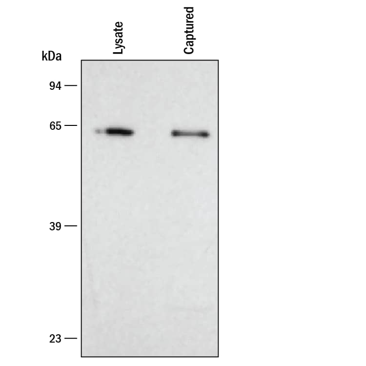 Lysates prepared from Jurkat human acute T cell leukemia cells were incubated in wells coated with Human Total HSP60 Capture Antibody. Unbound material was removed by washing and bound material was solubilized in SDS gel sample buffer. The same lysate and captured proteins were electrophoresed, transferred to an Immobilon-P membrane (Millipore) and immunoblotted with Human Total HSP60 Detection Antibody. Only a single band corresponding to HSP60 was detected. To further determine specificity, recombinant human (rh) HSP27 (Catalog # 1580-HS) and rhHSP70 (Catalog # AP-100) were assayed at 400 ng/mL and did not cross-react or interfere in the assay.