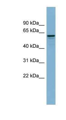 Western Blot: dynactin 4 Antibody [NBP1-55215] - Human Muscle lysate, concentration 0.2-1 ug/ml.