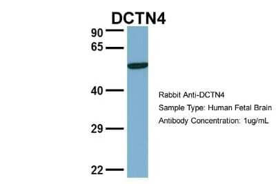 Western Blot: dynactin 4 Antibody [NBP1-55215] - Human Fetal Brain, Antibody Dilution: 1.0 ug/ml.