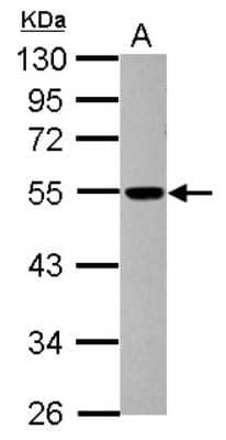 Western Blot: dynactin 4 Antibody [NBP2-16242] - Sample (30 ug of whole cell lysate) A: SK-N-SH 10% SDS PAGE gel, diluted at 1:1000.