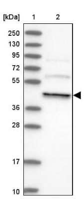 Western Blot dynactin 4 Antibody