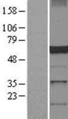 Western Blot dynactin 4 Overexpression Lysate