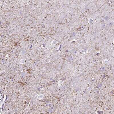 Immunohistochemistry dystrophia myotonica containing WD repeat motif Antibody - BSA Free