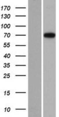 Western Blot dystrophia myotonica containing WD repeat motif Overexpression Lysate