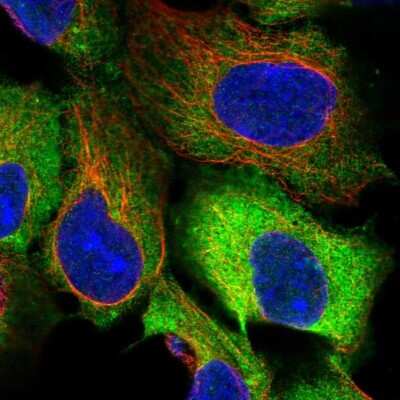 <b>Independent Antibodies Validation. </b>Immunocytochemistry/Immunofluorescence: eEF-2 Antibody [NBP2-57792] - Staining of human cell line HEK 293 shows localization to plasma membrane, cytosol & aggresome.